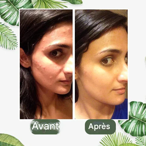 Diystar™ 100% Natural Green Tea Deep Cleansing Mask
