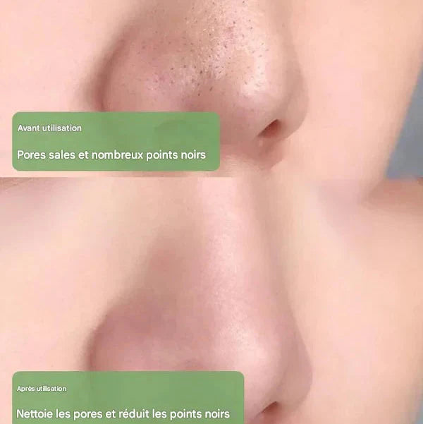 Diystar™ 100% Natural Green Tea Deep Cleansing Mask