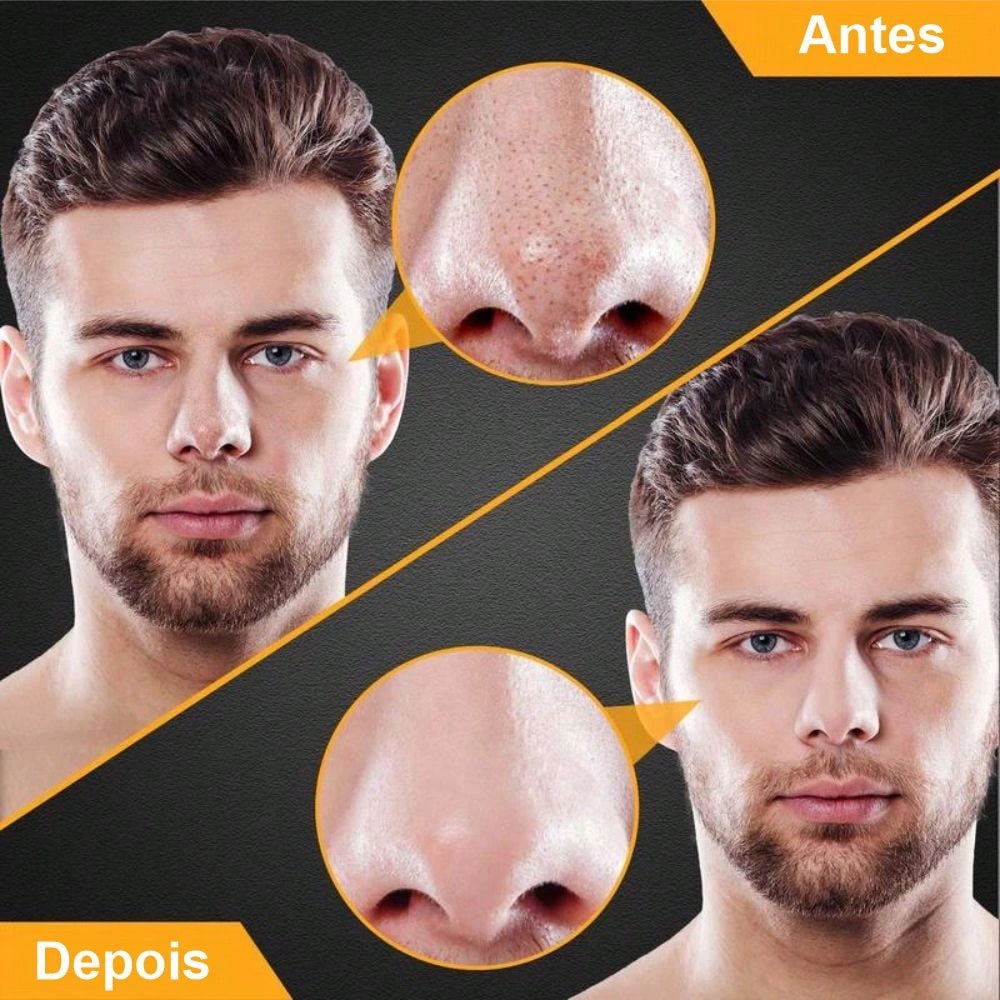 Blackhead Remover Peel-Off Mask