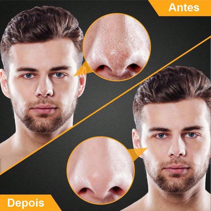 Blackhead Remover Peel-Off Mask