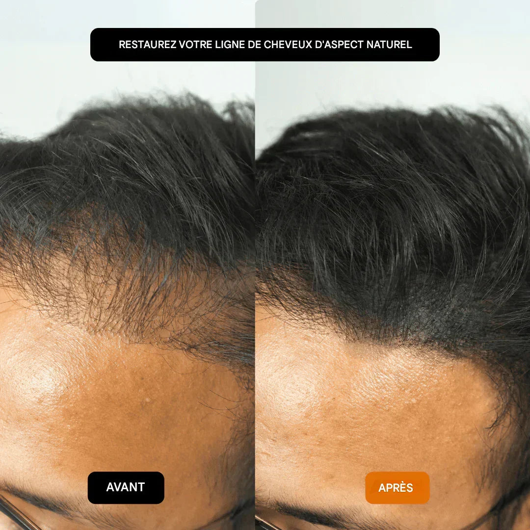 GROWY™ Hair Powder - Buy 1 get 2 free