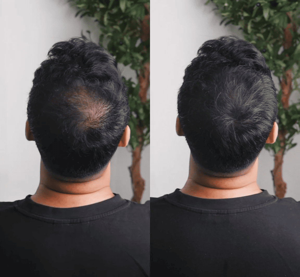 GROWY™ Hair Powder - Buy 1 get 2 free