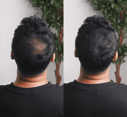 GROWY™ Hair Powder - Buy 1 get 2 free
