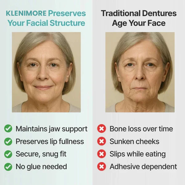 KLENIMORE™ Medical Full Denture with Strong Suction