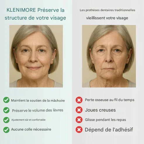 KLENIMORE™ Professional Medical Full Denture with Strong Suction
