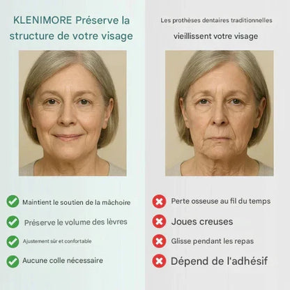 KLENIMORE™ Professional Medical Full Denture with Strong Suction