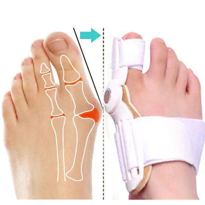 Unisex Bunion Corrector – Perfect Fit – Buy 1 Get 2 Free