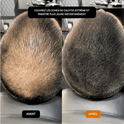 GROWY™ Hair Powder - Buy 1 get 2 free